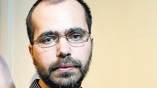 This Professor Is Surgically Implanting a Camera in the Back of His Head